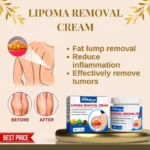 Lipoma Removal Cream 50gm Body Smoothing - Image 4