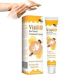 Vitigo Bee Venom Treatment Cream | Natural Skin Repair Hydration Relief Anti-Irritation - Image 6
