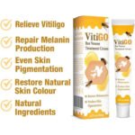 Vitigo Bee Venom Treatment Cream | Natural Skin Repair Hydration Relief Anti-Irritation - Image 5