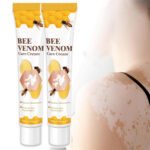 Vitigo Bee Venom Treatment Cream | Natural Skin Repair Hydration Relief Anti-Irritation - Image 2
